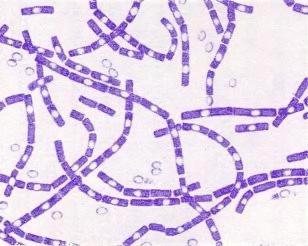 731曾疯狂培育的炭疽杆菌又双叒出现了！它究竟多可怕？